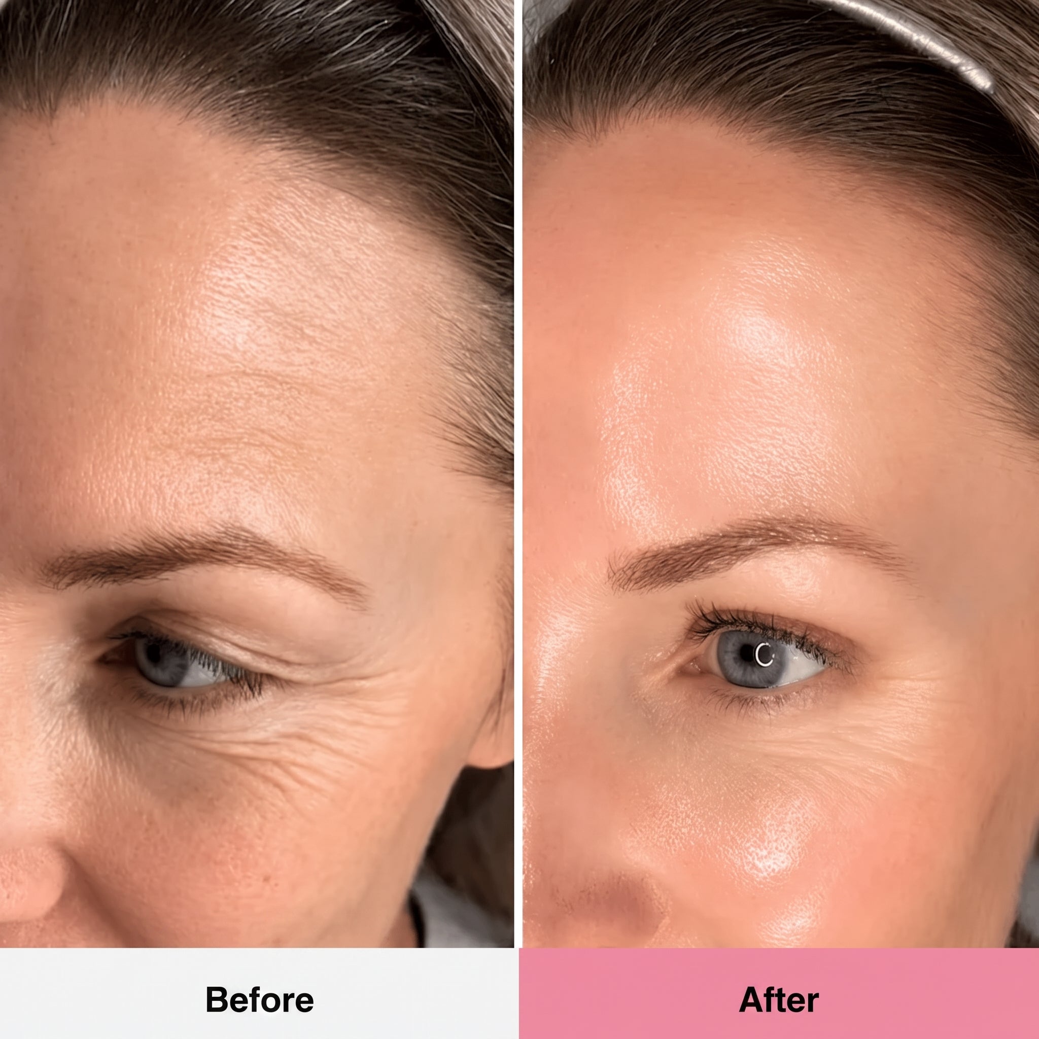 Rosé PDRN Collagen Balm