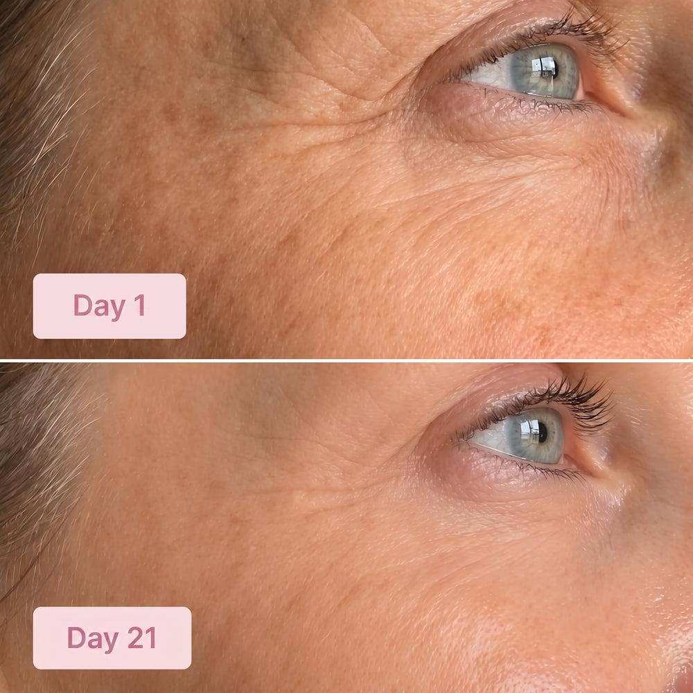 SoleneDerm Rosé Balm